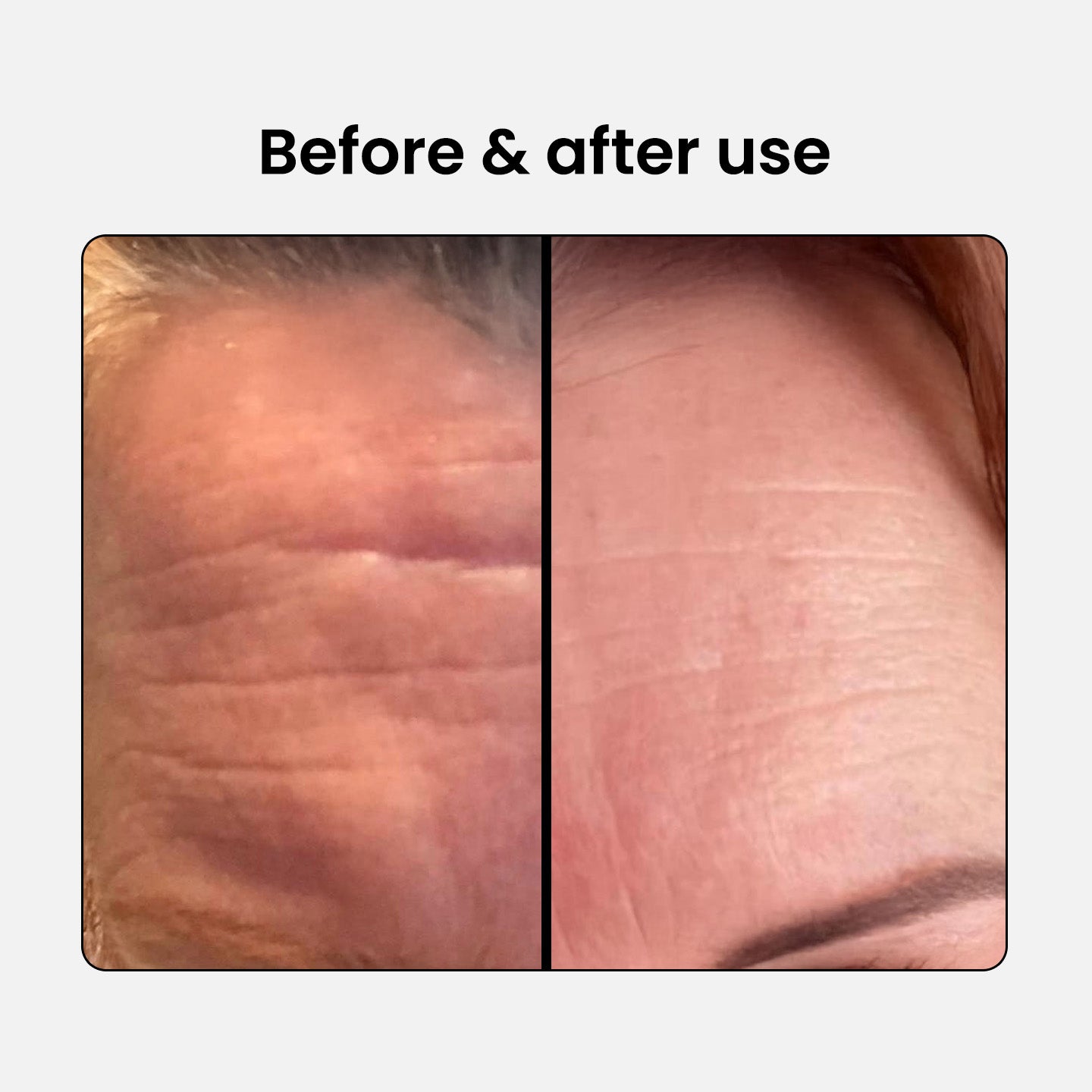 Anti-Aging Beauty Collagen Complex 1 plus 1 free
