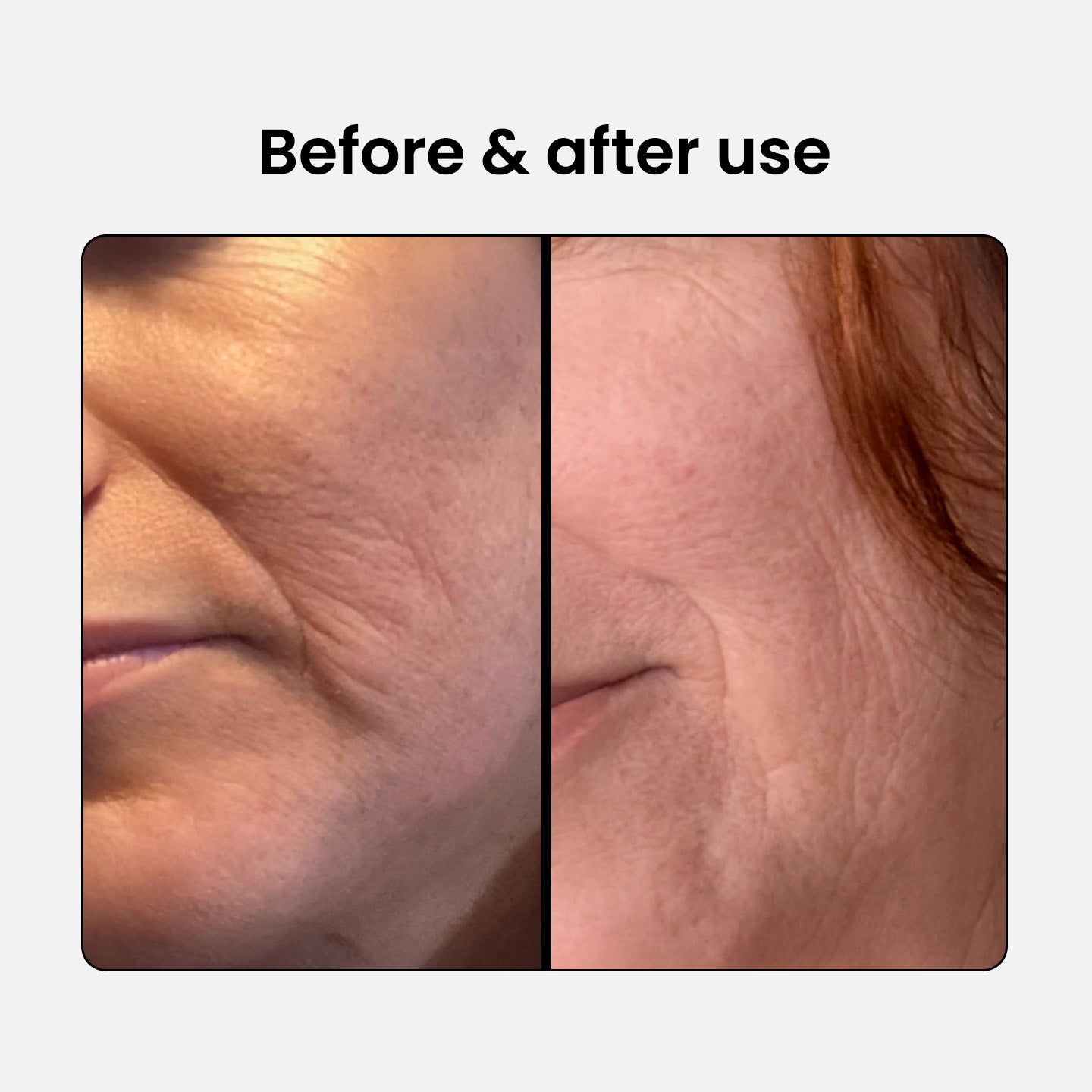 Anti-Aging Beauty Collagen Complex 1 plus 1 free