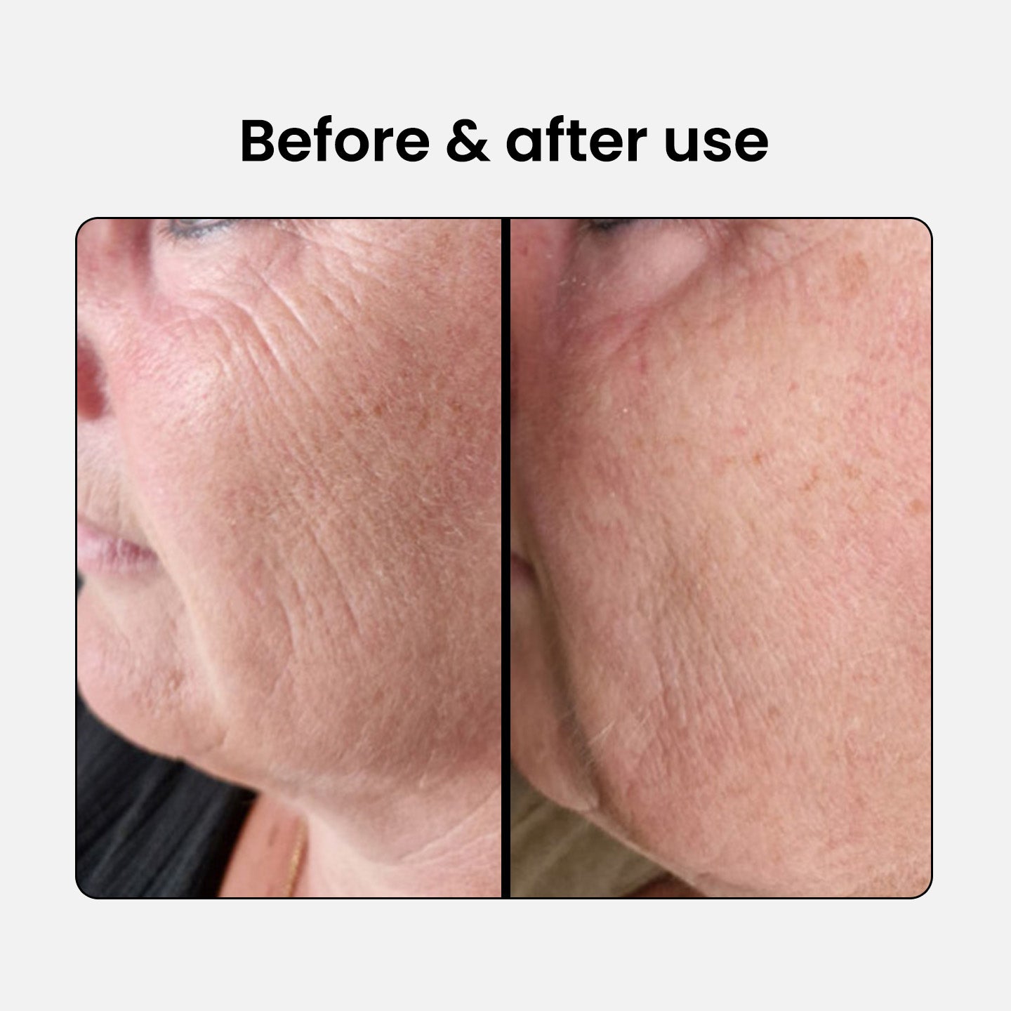 Anti-Aging Beauty Collagen Complex 1 plus 1 free