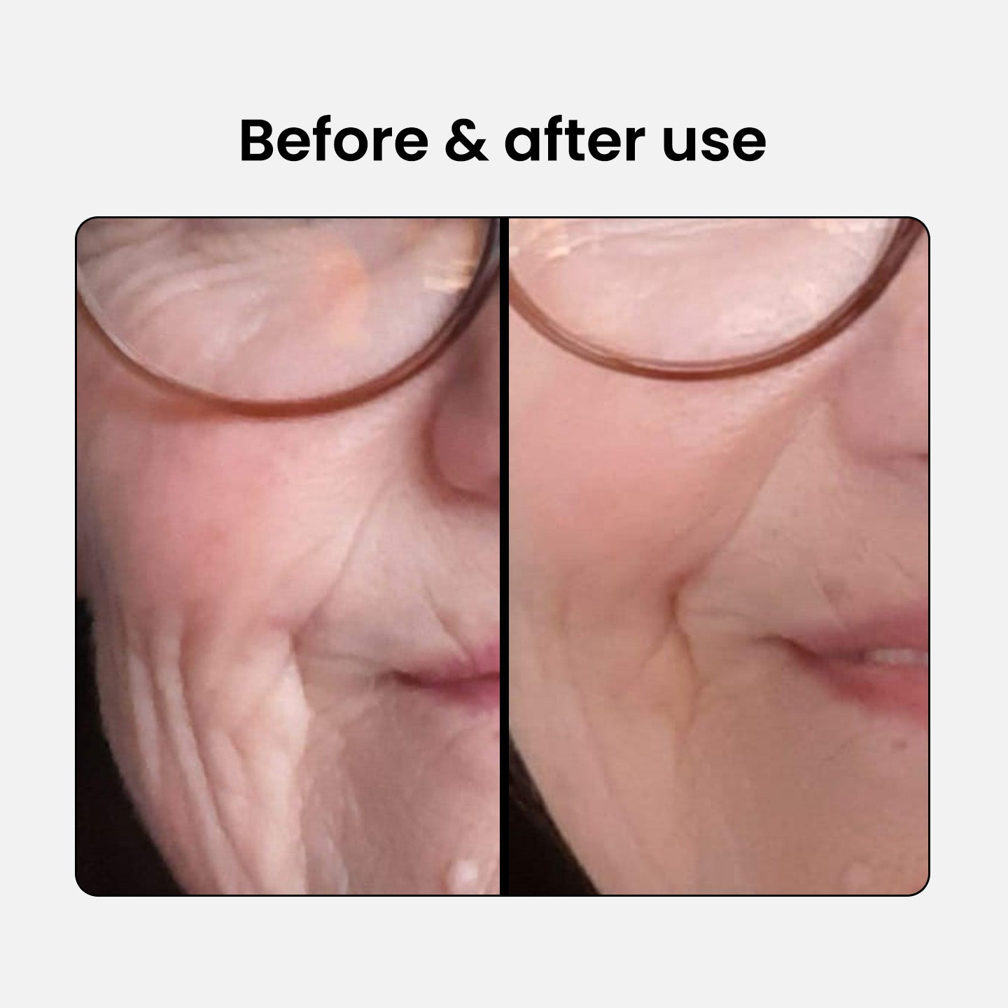 Anti-Aging Beauty Collagen Complex 1 plus 1 free