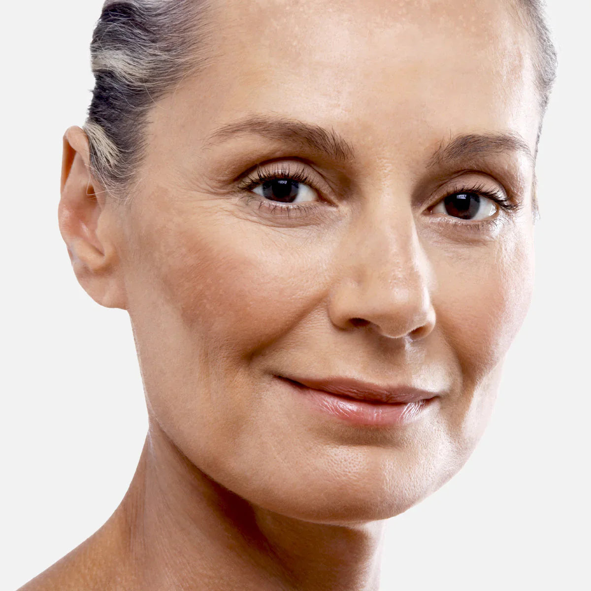 Pigment Spots