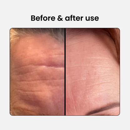 Anti-Aging Beauty Collagen Complex 1 plus 1 free
